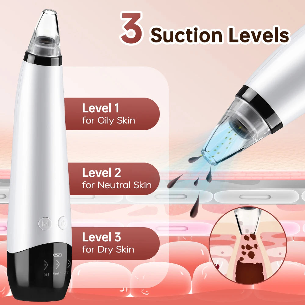 Blackhead Remover Facial Pore Cleaner