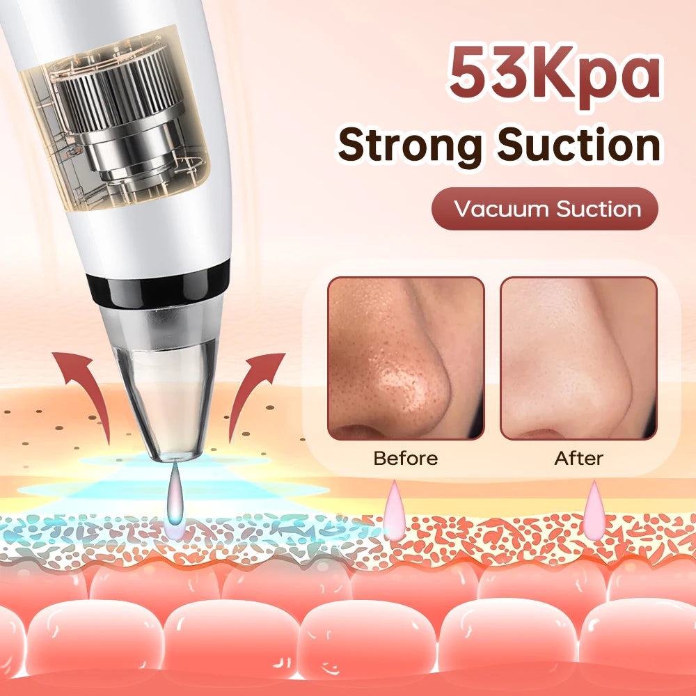 Blackhead Remover Facial Pore Cleaner